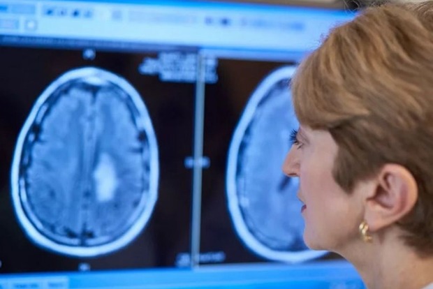 Ученые перечислили симптомы рака мозга, на которые часто не обращают внимания